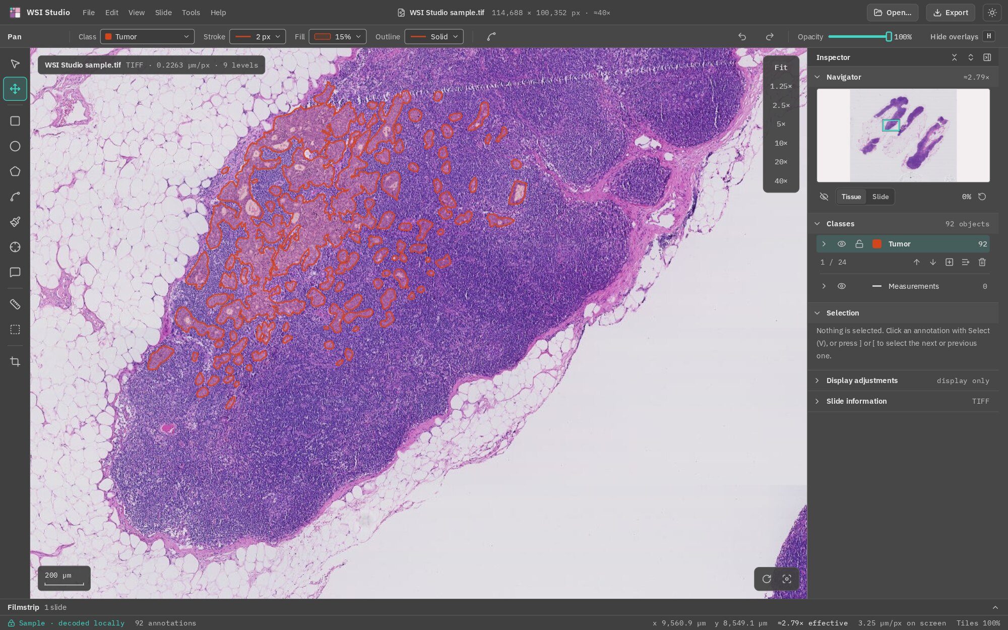 WSI Studio showing a lymph node slide zoomed in, with tumour regions outlined in red and the inspector listing 92 annotations